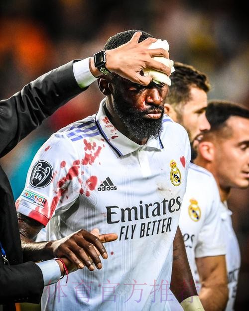 欧冠-吕迪格95分钟绝平+血染赛场!皇马1-1提前出线